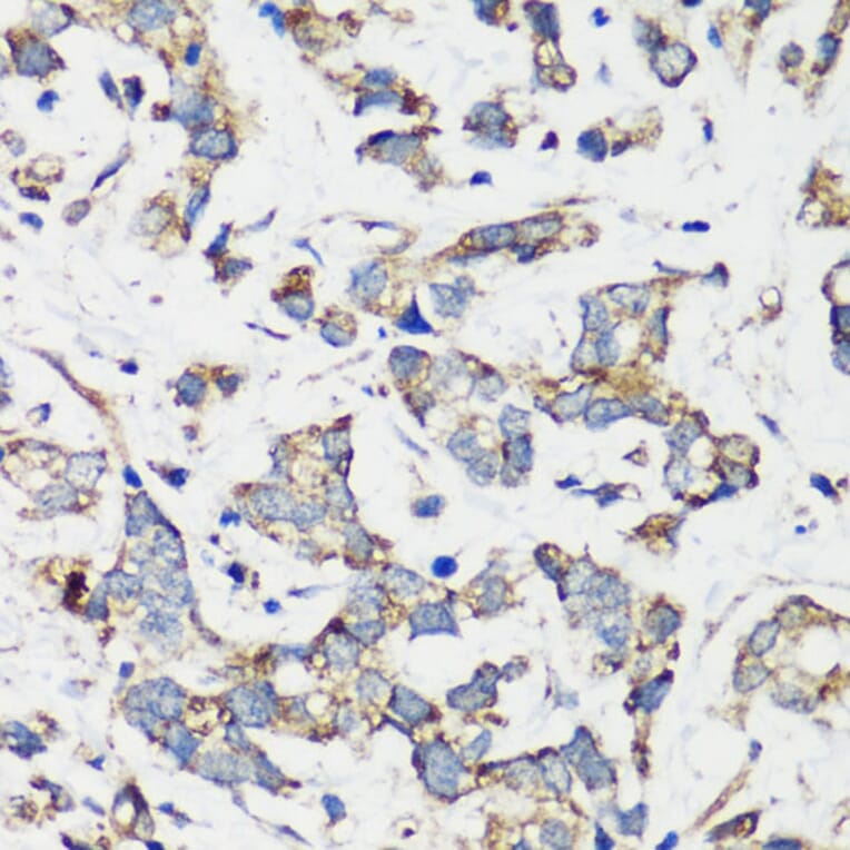 Immunohistochemistry - Anti-Hamartin Antibody (A12695) - Antibodies.com