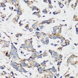 Immunohistochemistry - Anti-Hamartin Antibody (A12695) - Antibodies.com