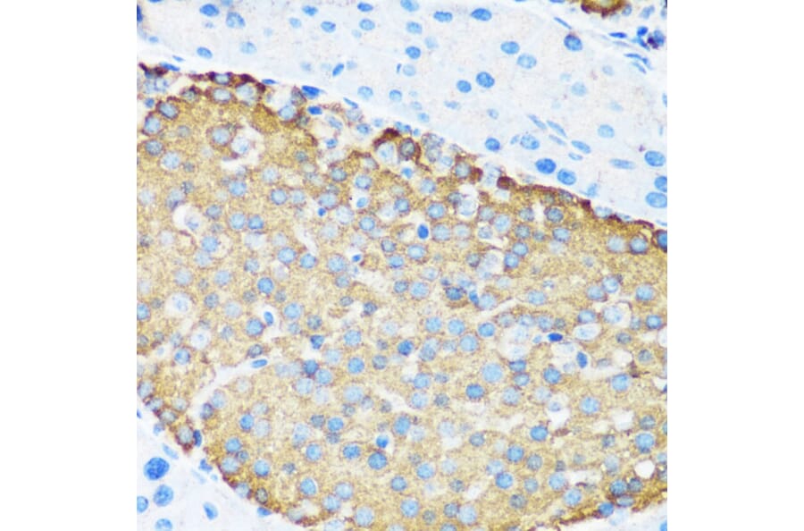 Immunohistochemistry - Anti-Hamartin Antibody (A12695) - Antibodies.com