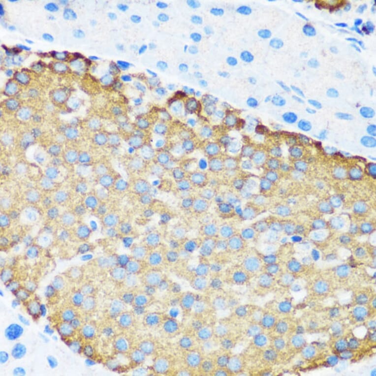 Immunohistochemistry - Anti-Hamartin Antibody (A12695) - Antibodies.com