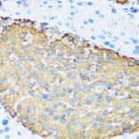 Immunohistochemistry - Anti-Hamartin Antibody (A12695) - Antibodies.com