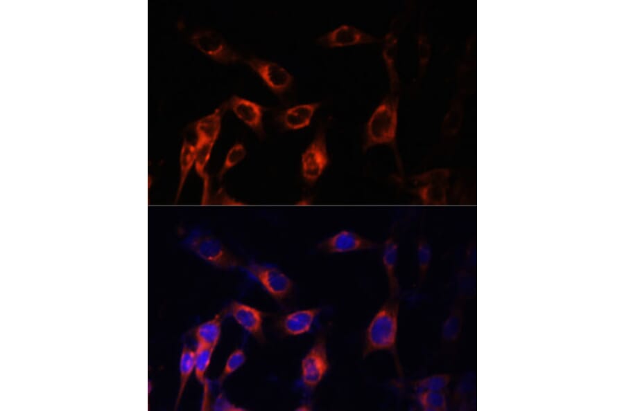 Immunofluorescence - Anti-Hamartin Antibody (A12695) - Antibodies.com