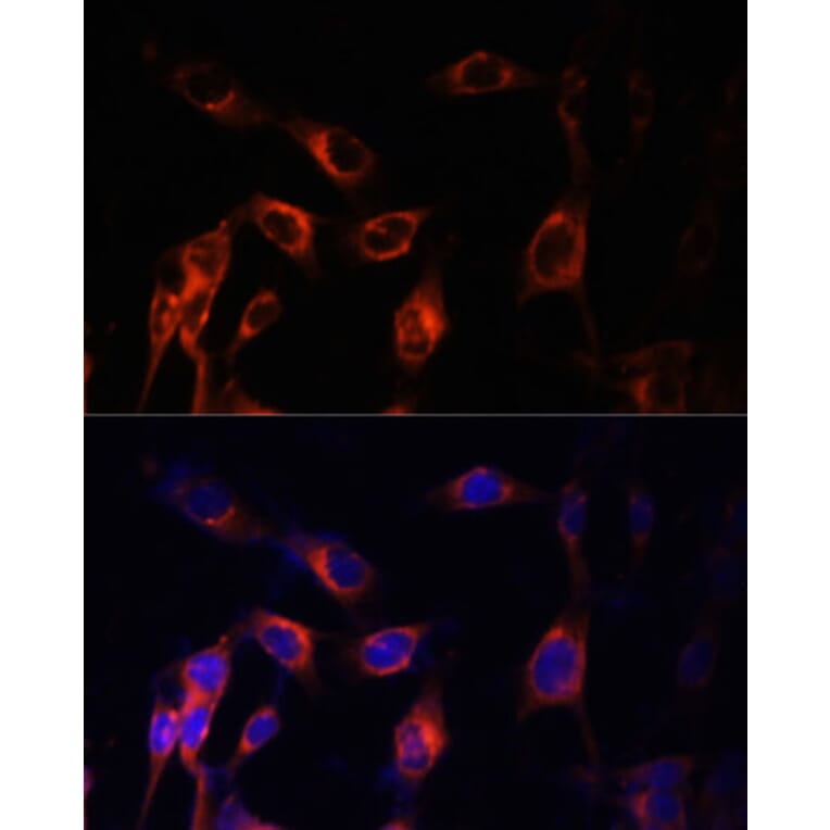 Immunofluorescence - Anti-Hamartin Antibody (A12695) - Antibodies.com