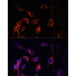 Immunofluorescence - Anti-Hamartin Antibody (A12695) - Antibodies.com