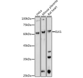 Western Blot - Anti-ELK1 Antibody (A12697) - Antibodies.com