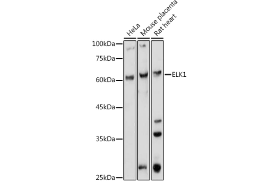 Western Blot - Anti-ELK1 Antibody (A12697) - Antibodies.com