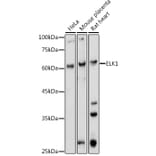 Western Blot - Anti-ELK1 Antibody (A12697) - Antibodies.com