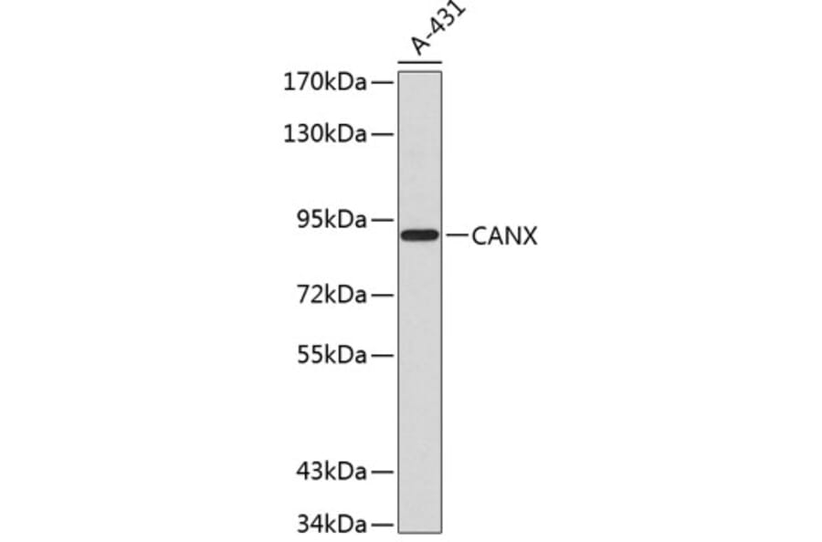 Western Blot - Anti-CANX Antibody (A0803) - Antibodies.com