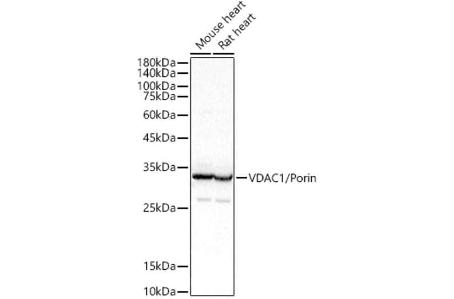 Western Blot - Anti-VDAC1/Porin Antibody (A12700) - Antibodies.com
