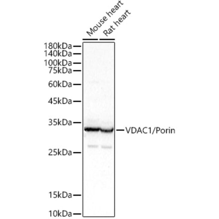 Western Blot - Anti-VDAC1/Porin Antibody (A12700) - Antibodies.com