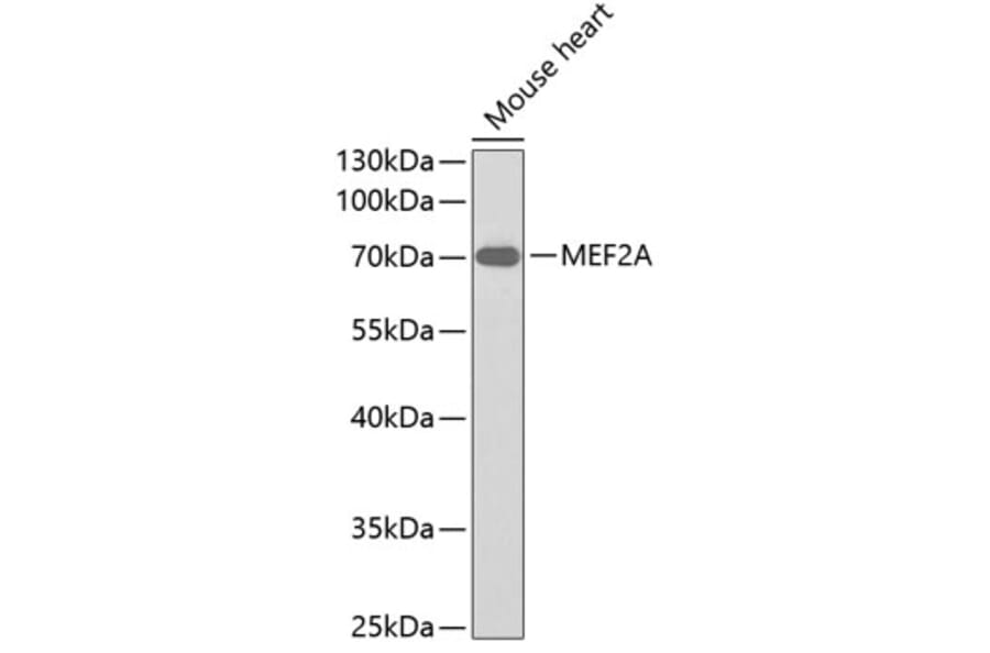 Western Blot - Anti-MEF2A Antibody (A0845) - Antibodies.com