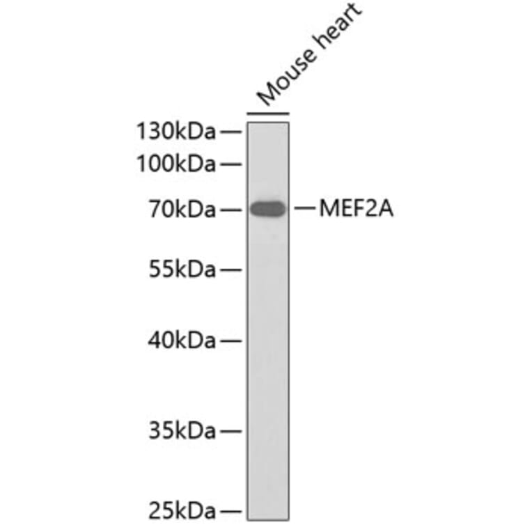Western Blot - Anti-MEF2A Antibody (A0845) - Antibodies.com