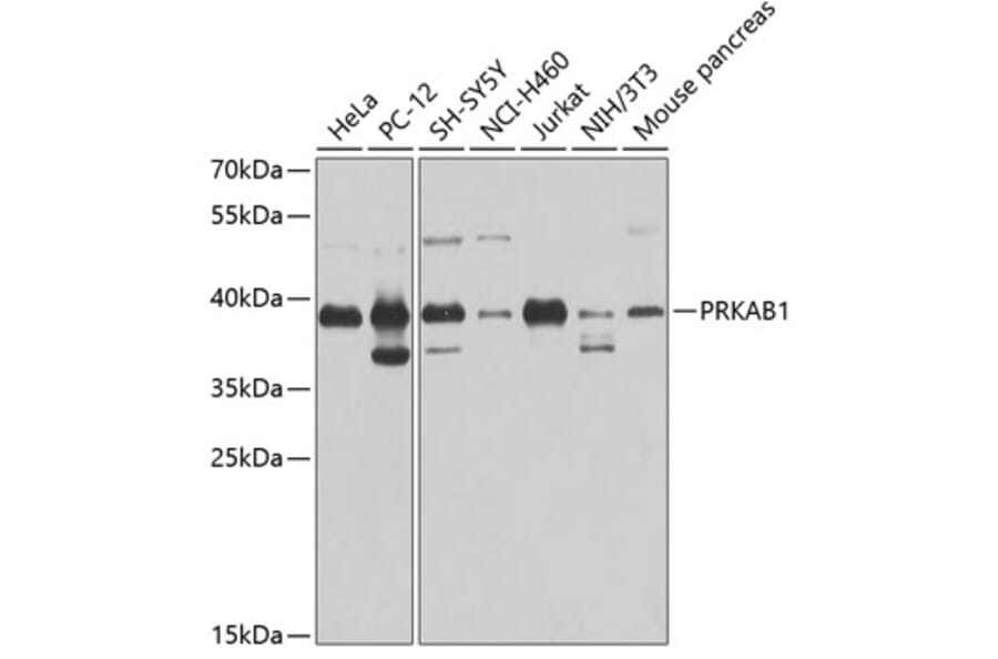 Western Blot - Anti-PRKAB1 Antibody (A0846) - Antibodies.com