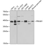 Western Blot - Anti-PRKAB1 Antibody (A0846) - Antibodies.com