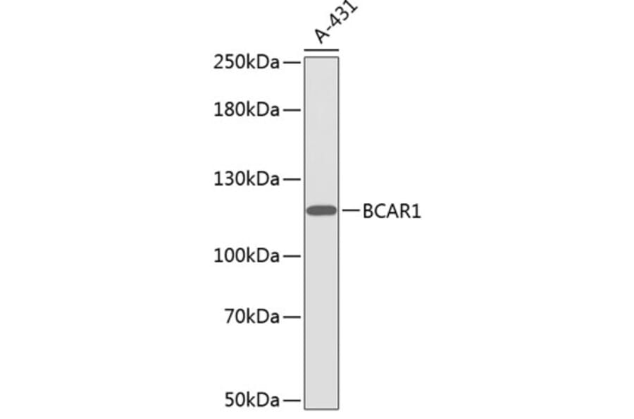 Western Blot - Anti-BCAR1 Antibody (A0855) - Antibodies.com