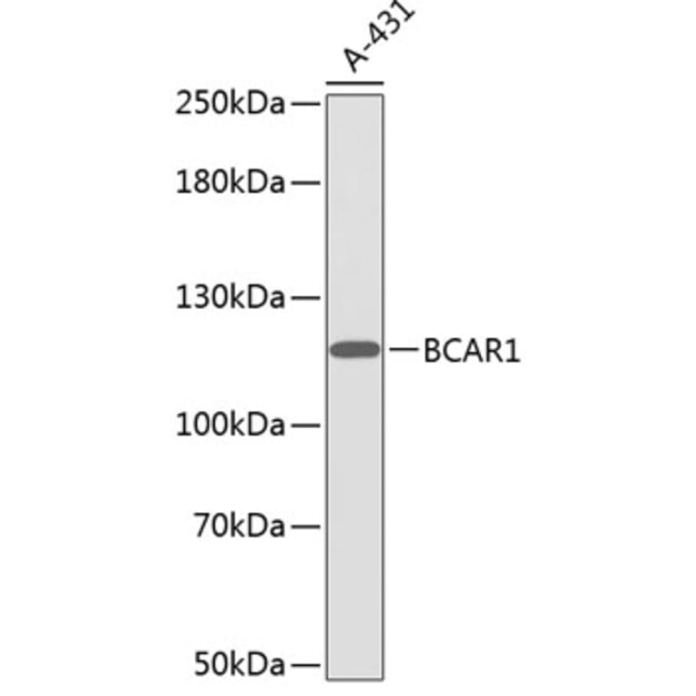 Western Blot - Anti-BCAR1 Antibody (A0855) - Antibodies.com