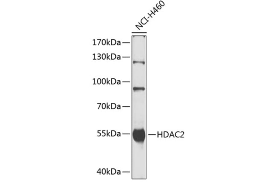 Western Blot - Anti-HDAC2 Antibody (A0867) - Antibodies.com