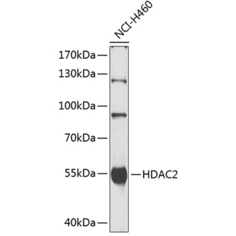 Western Blot - Anti-HDAC2 Antibody (A0867) - Antibodies.com