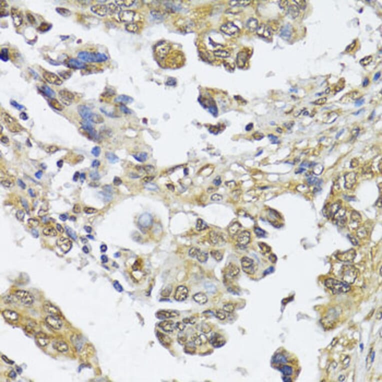 Immunohistochemistry - Anti-HDAC2 Antibody (A0867) - Antibodies.com