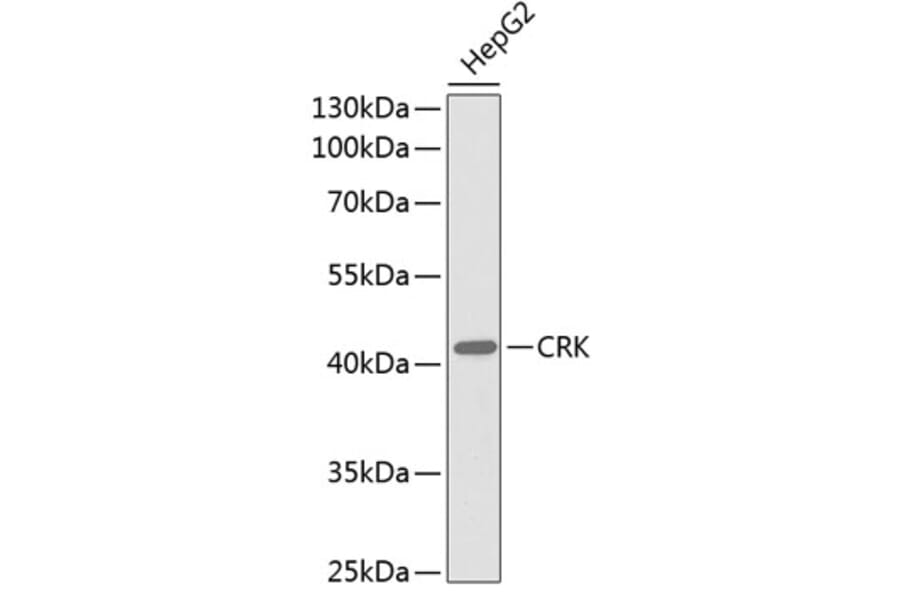 Western Blot - Anti-CRK Antibody (A0868) - Antibodies.com