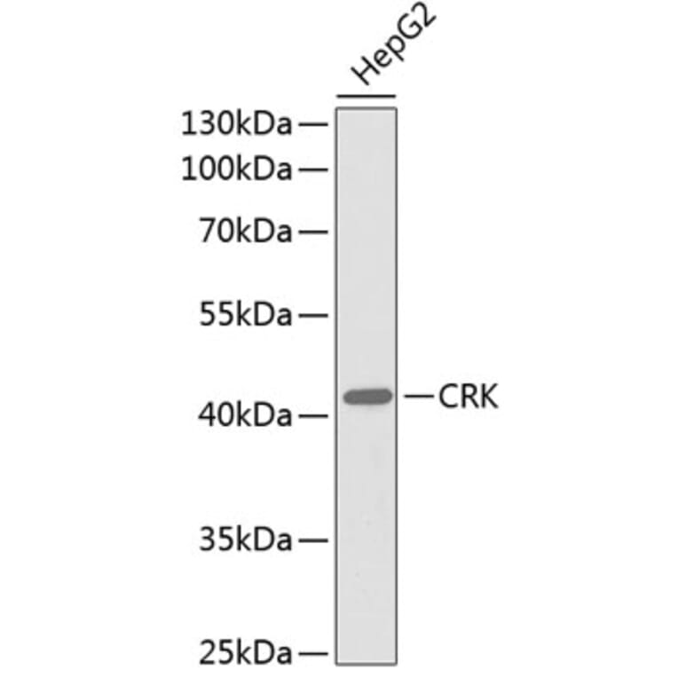 Western Blot - Anti-CRK Antibody (A0868) - Antibodies.com