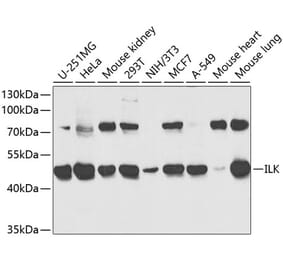 Western Blot - Anti-Integrin linked ILK Antibody (A12709) - Antibodies.com