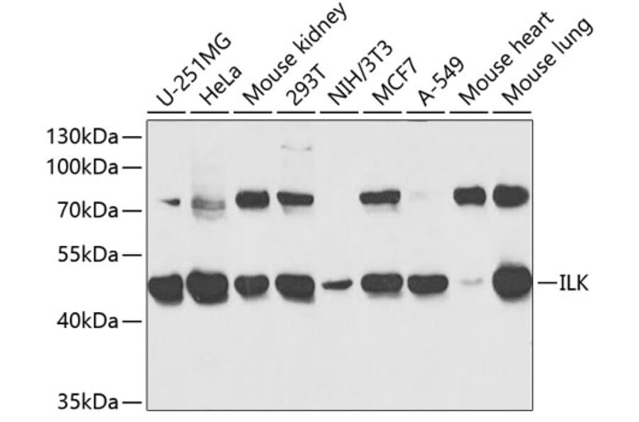 Western Blot - Anti-Integrin linked ILK Antibody (A12709) - Antibodies.com