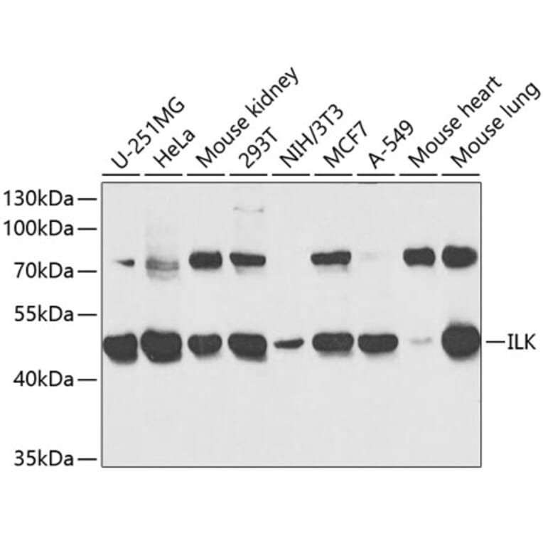 Western Blot - Anti-Integrin linked ILK Antibody (A12709) - Antibodies.com