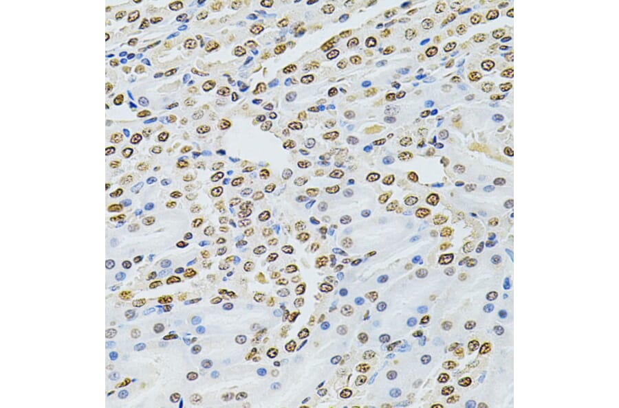 Immunohistochemistry - Anti-Integrin linked ILK Antibody (A12709) - Antibodies.com