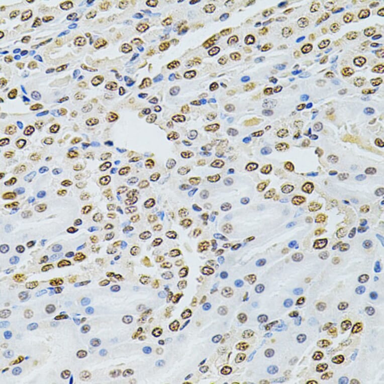 Immunohistochemistry - Anti-Integrin linked ILK Antibody (A12709) - Antibodies.com