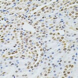 Immunohistochemistry - Anti-Integrin linked ILK Antibody (A12709) - Antibodies.com