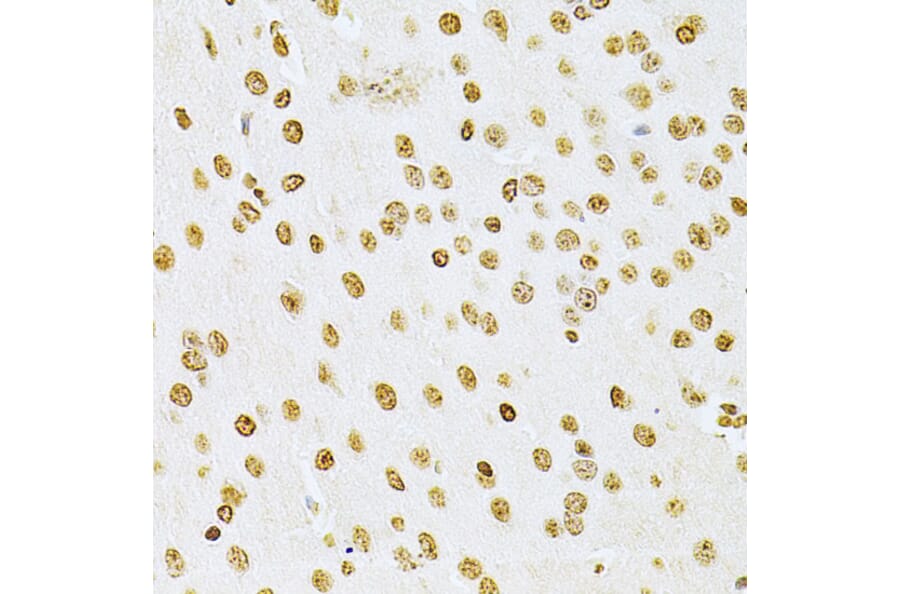 Immunohistochemistry - Anti-Integrin linked ILK Antibody (A12709) - Antibodies.com