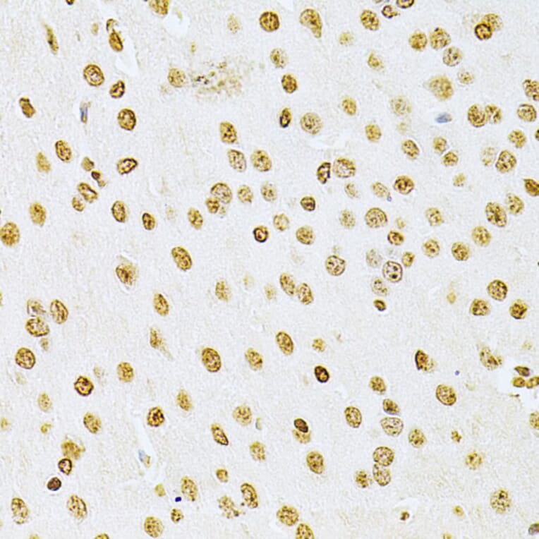 Immunohistochemistry - Anti-Integrin linked ILK Antibody (A12709) - Antibodies.com