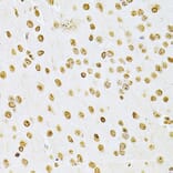 Immunohistochemistry - Anti-Integrin linked ILK Antibody (A12709) - Antibodies.com