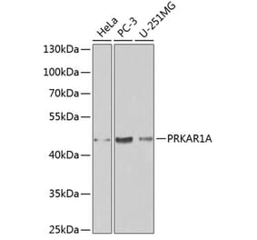 Western Blot - Anti-PRKAR1A Antibody (A12710) - Antibodies.com