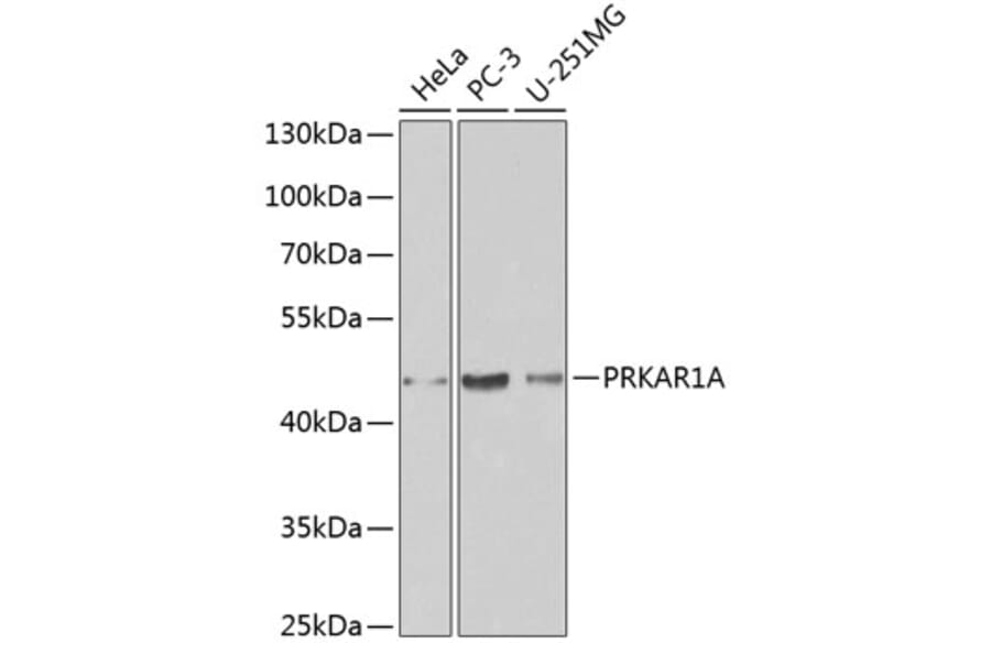 Western Blot - Anti-PRKAR1A Antibody (A12710) - Antibodies.com