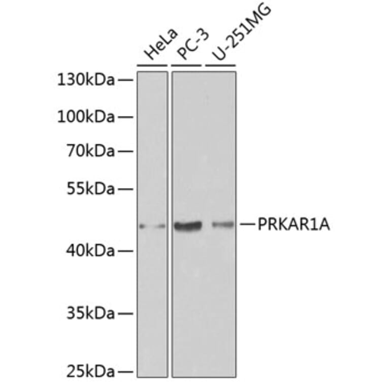 Western Blot - Anti-PRKAR1A Antibody (A12710) - Antibodies.com