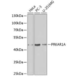 Western Blot - Anti-PRKAR1A Antibody (A12710) - Antibodies.com