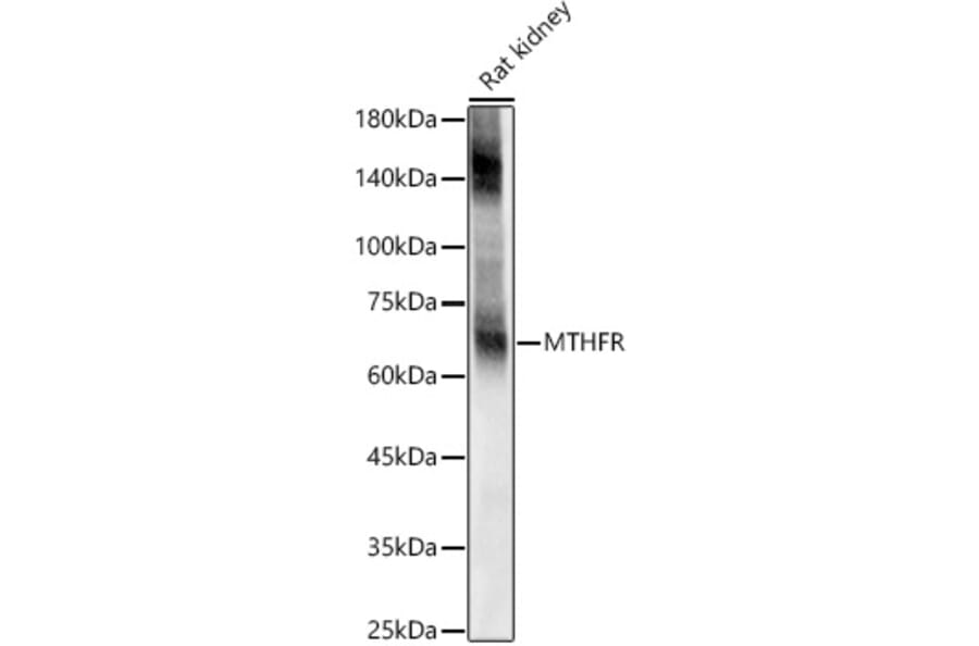 Western Blot - Anti-EAAT2 Antibody (A12711) - Antibodies.com
