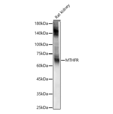 Western Blot - Anti-EAAT2 Antibody (A12711) - Antibodies.com