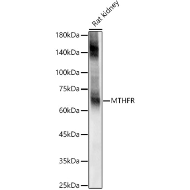 Western Blot - Anti-EAAT2 Antibody (A12711) - Antibodies.com