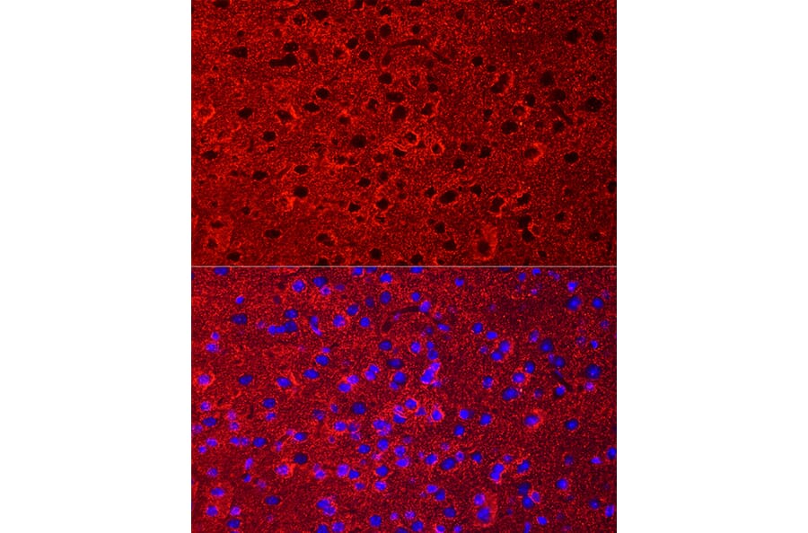 Immunofluorescence - Anti-EAAT2 Antibody (A12711) - Antibodies.com