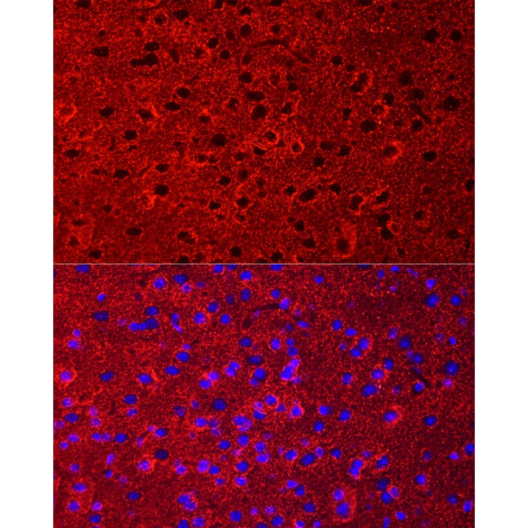 Immunofluorescence - Anti-EAAT2 Antibody (A12711) - Antibodies.com