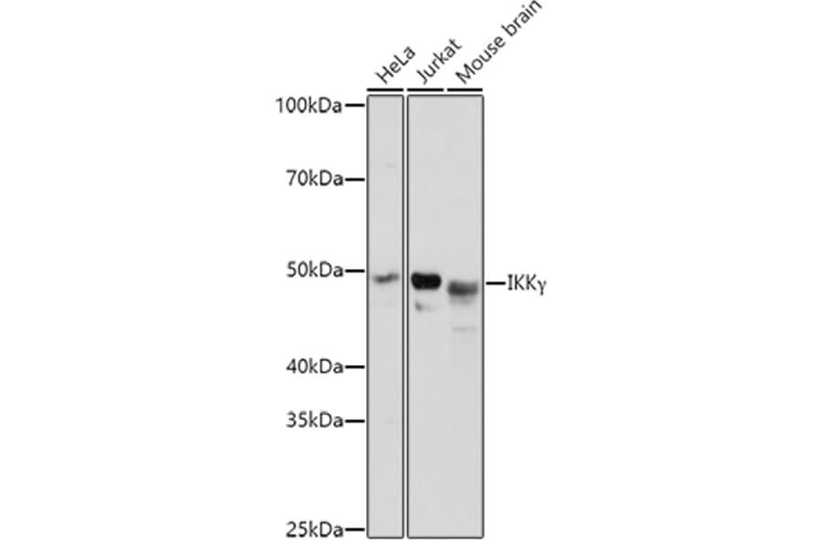 Western Blot - Anti-IKK gamma/NEMO Antibody (A12712) - Antibodies.com