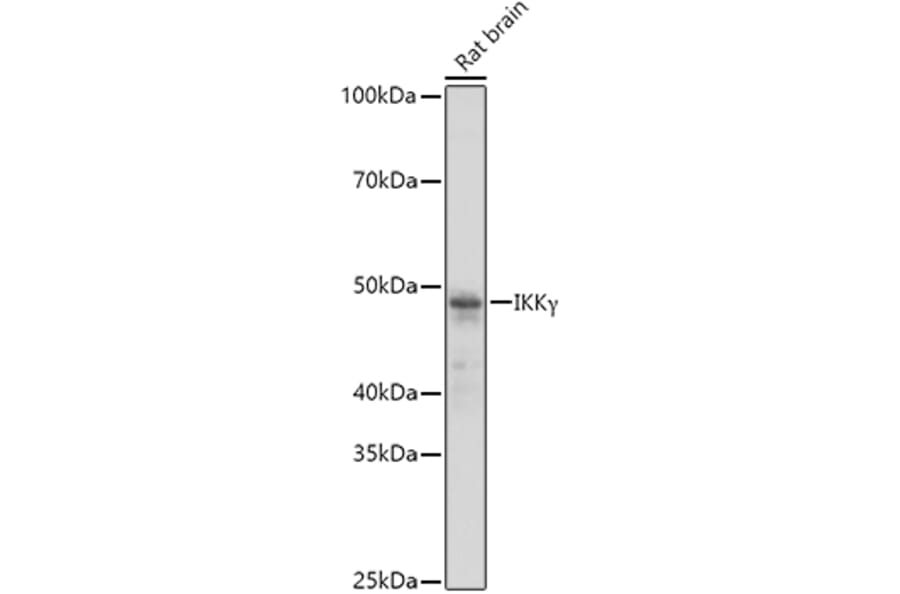Western Blot - Anti-IKK gamma/NEMO Antibody (A12712) - Antibodies.com