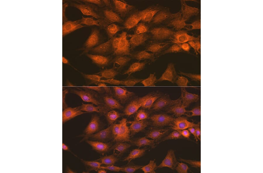 Immunofluorescence - Anti-IKK gamma/NEMO Antibody (A12712) - Antibodies.com