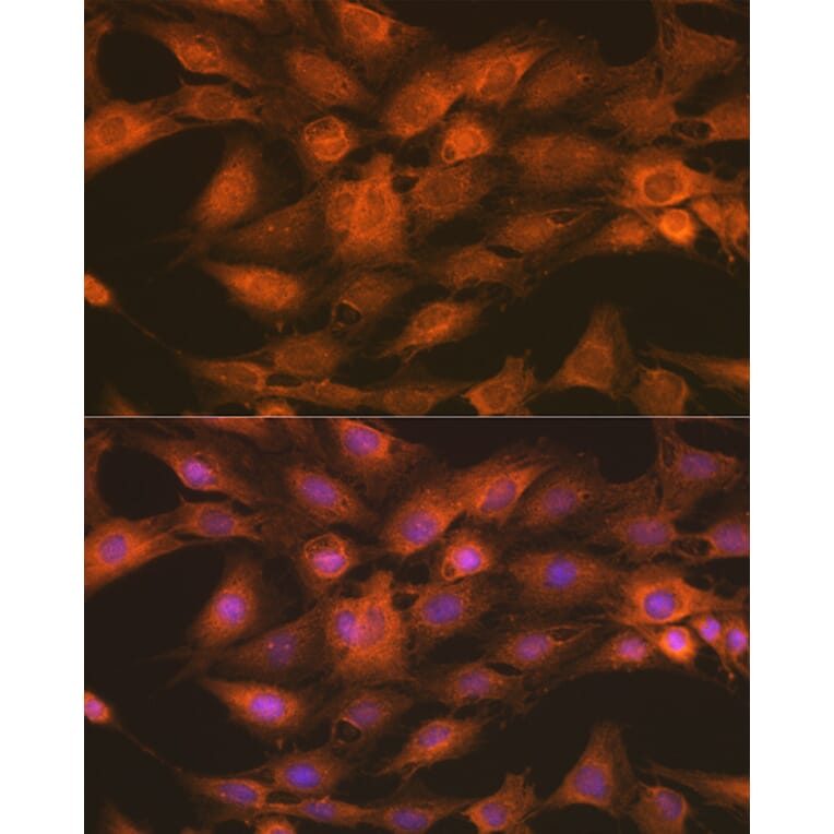 Immunofluorescence - Anti-IKK gamma/NEMO Antibody (A12712) - Antibodies.com