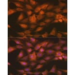 Immunofluorescence - Anti-IKK gamma/NEMO Antibody (A12712) - Antibodies.com