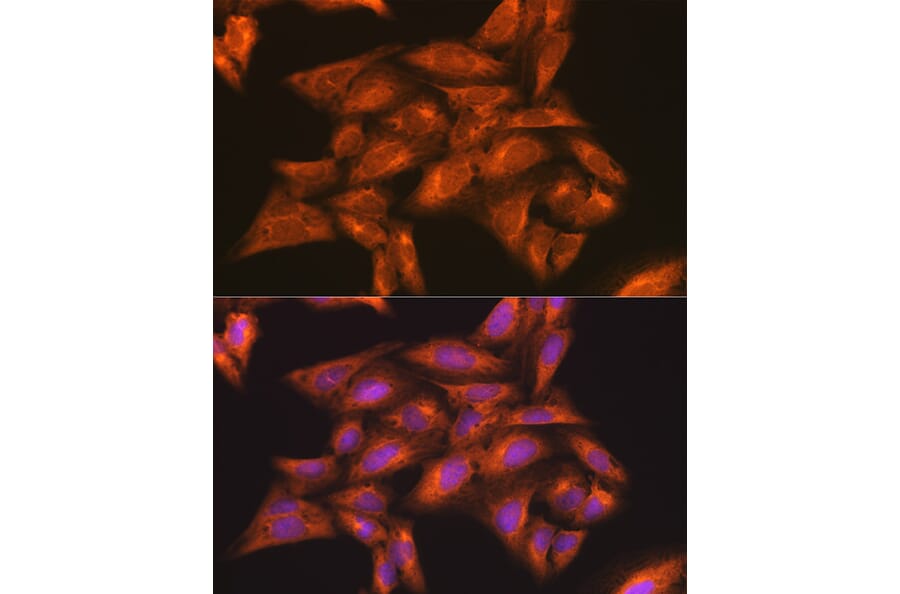 Immunofluorescence - Anti-IKK gamma/NEMO Antibody (A12712) - Antibodies.com