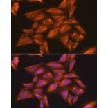 Immunofluorescence - Anti-IKK gamma/NEMO Antibody (A12712) - Antibodies.com